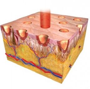 Epiderme