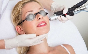 como é realizado o procedimento de rejuvenescimento da pele facial a laser 