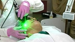 prós e contras do rejuvenescimento da pele facial a laser