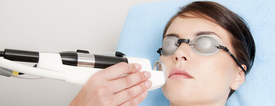 Rejuvenescimento a laser de campo da pele facial