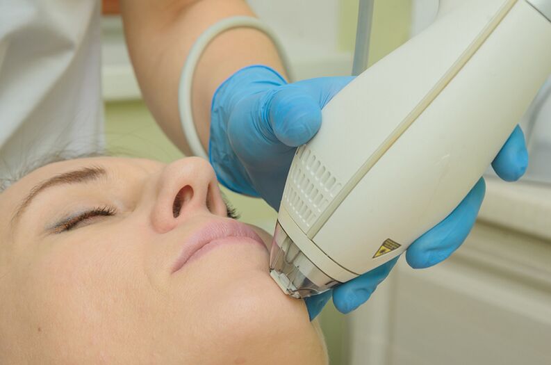 Rejuvenescimento a laser