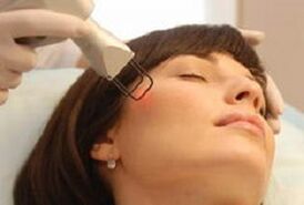 a essência do procedimento de rejuvenescimento fracionado da pele facial com laser