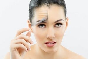Quais problemas de pele o rejuvenescimento a laser trata