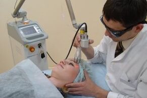 procedimento de rejuvenescimento da pele facial a laser